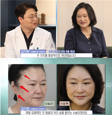 뷰티플페이스 이미지